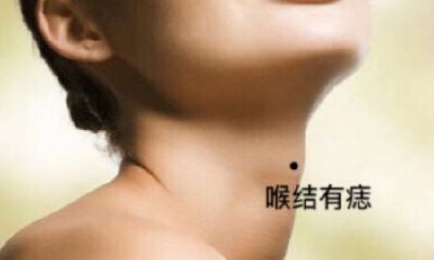 女人喉结有痣代表什么，女人喉结有痣好不好