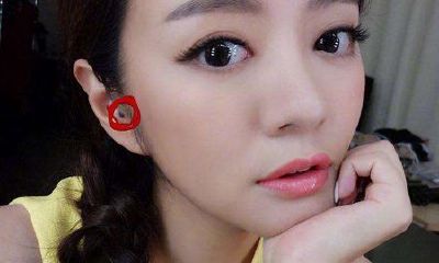 耳内有痣代表什么