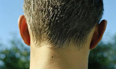 男人脖子后边有痣相与事业