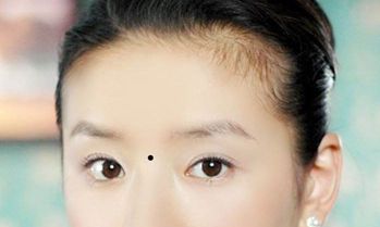 女人山根有痣命运如何