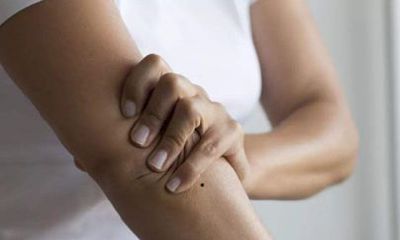 手臂的活痣代表什么