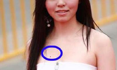 胸上痣的位置与命运