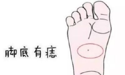 男人右脚脚底有痣的四种吉兆