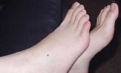 脚底有痣的命运