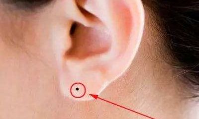 耳珠有痣好不好