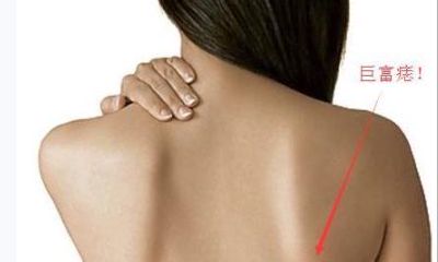 巨富痣真的会富吗 都长在哪些地方