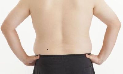 人背痣穷一生的说法对吗