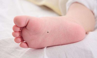 女人右脚底痣的位置图