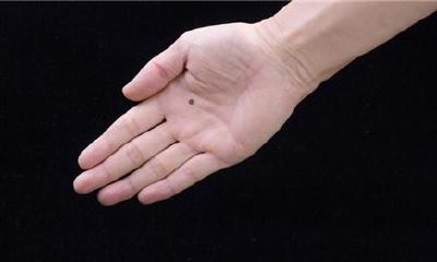 手掌有痣人中龙凤的各种说法