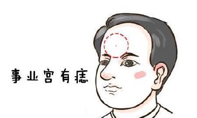 男人人中龙凤痣有哪些