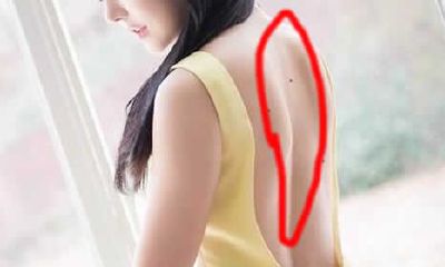 女人巨富痣长在哪里的，女人巨富痣解读