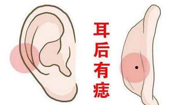 看痣的位置算命图解