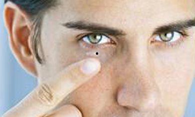 男人眼袋长痣代表什么