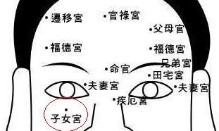 眼袋下面有痣面相眼睛下面有痣