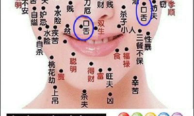 口舌痣