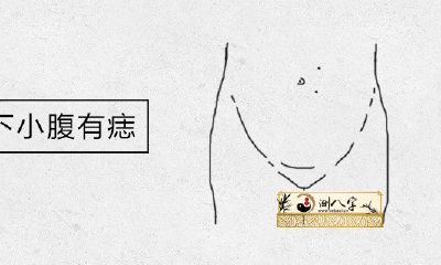 女人肚脐下小肚子有痣