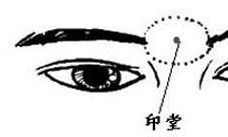 印堂有痣的面相命运如何呢