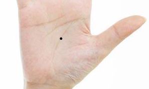 生命线上长痣代表什么