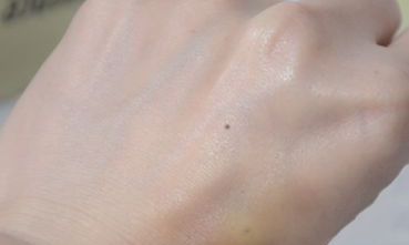 手背长痣图解大全