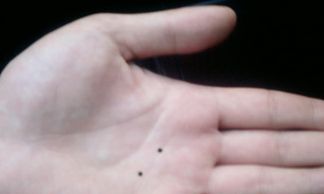 男人左手手掌痣图解