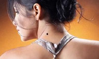 脖子后面长痣好不好