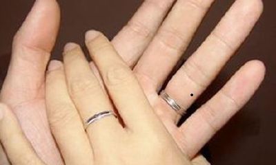 无名指内侧长痣代表什么