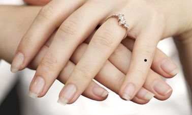 女生左手小拇指有痣代表什么