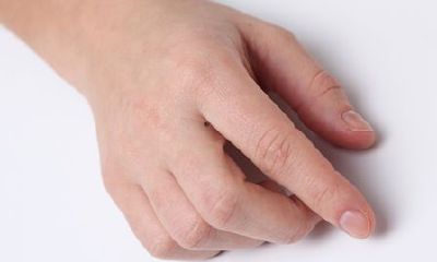 中指和食指夹缝里有痣代表什么