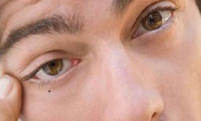 男人右眼睛下面有个痣代表什么