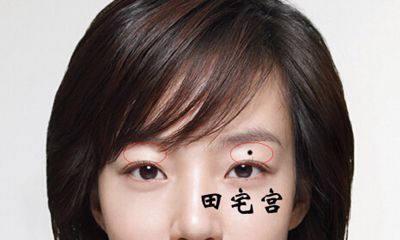 田宅宫有痣代表什么