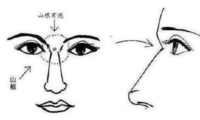 山根痣的准确位置图