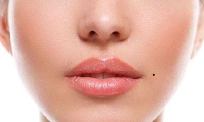 嘴巴左上角痣代表什么