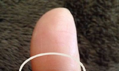 左手大拇指痣代表什么