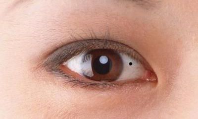 眼白有痣代表什么意思