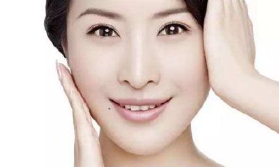 嘴角下方长痣代表什么