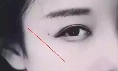 五颗贫穷痣，一生难富贵