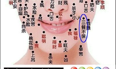 三餐不饱痣
