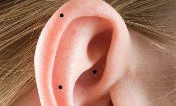 右耳朵长痣代表什么