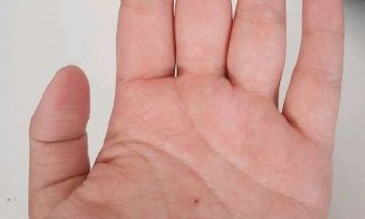 女人左手朱砂痣代表什么