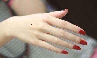 女人左手背有朱砂痣