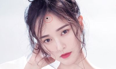 女人额头有痣是贵夫人