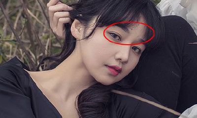 眉毛上的贵夫人痣