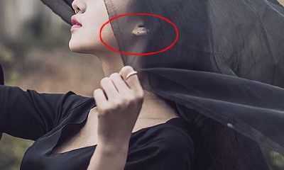 耳朵上的贵夫人痣