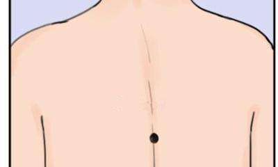 背的脊柱正中间长有痣，预示长寿