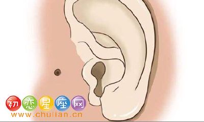 耳门有痣