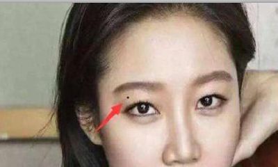 眼皮中藏痣的人