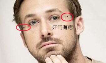 男人7种不得不知的凶痣全解