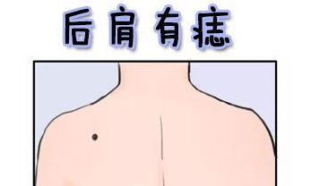 身体哪三处痣富贵命