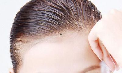 女人发际线正中间有痣