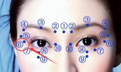 女人右眼眼尾鱼尾纹处有痣